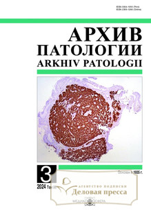 №3/2024 №3 за 2024 год - онлайн-версия журнала, купить и скачать электронную версию журнала Архив патологии (Россия). Агентство подписки "Деловая пресса"