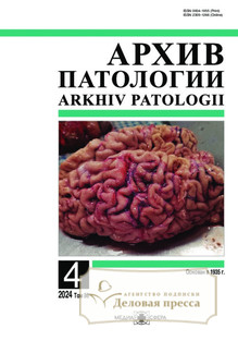 №4/2024 №4 за 2024 год - онлайн-версия журнала, купить и скачать электронную версию журнала Архив патологии (Россия). Агентство подписки "Деловая пресса"