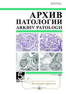 №5/2024 №5 за 2024 год - онлайн-версия журнала, купить и скачать электронную версию журнала Архив патологии (Россия). Агентство подписки "Деловая пресса"